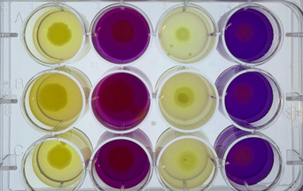 12-well plate with test solutions in yellow and violet